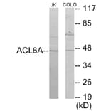 Western Blot - ACTL6A Cell Based ELISA Kit (CB5828) - Antibodies.com