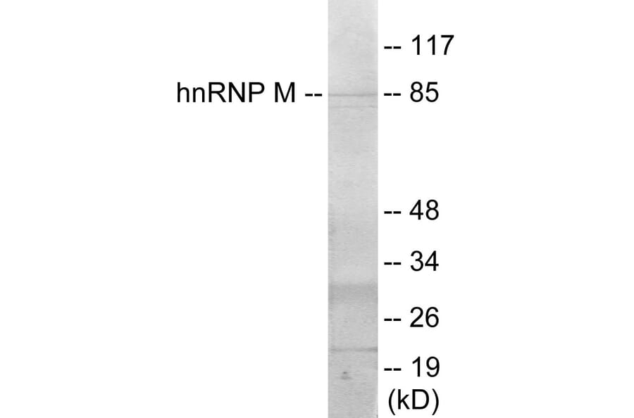 Western Blot - hnRNPM Cell Based ELISA Kit (CB5911) - Antibodies.com
