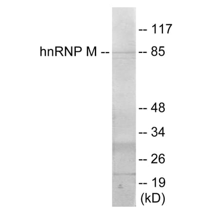 Western Blot - hnRNPM Cell Based ELISA Kit (CB5911) - Antibodies.com