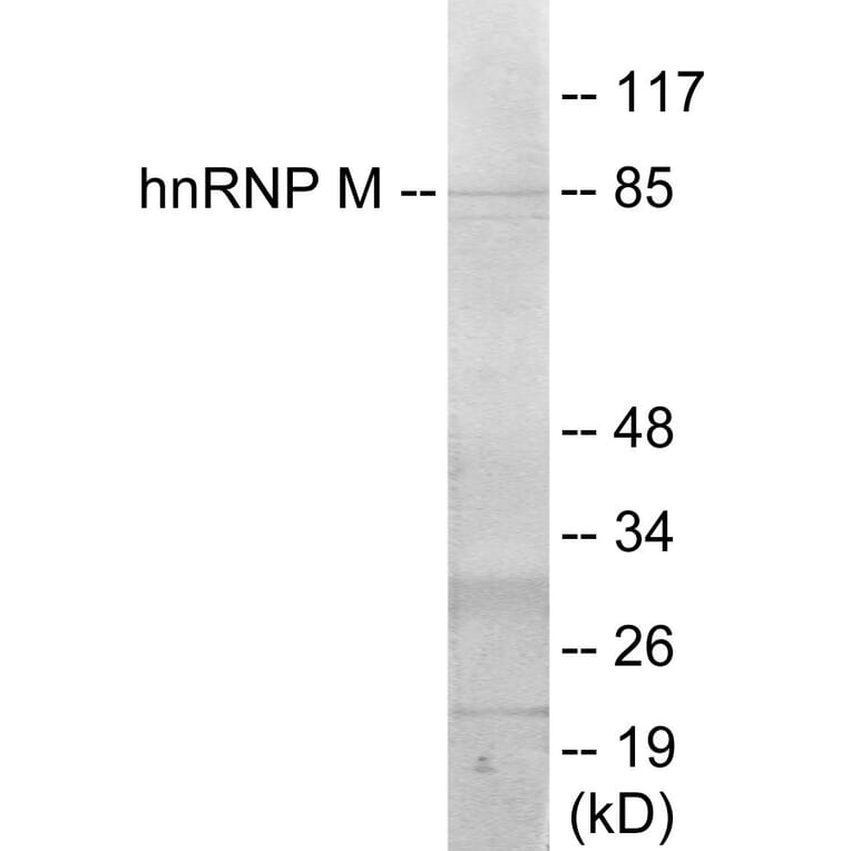 Western Blot - hnRNPM Cell Based ELISA Kit (CB5911) - Antibodies.com