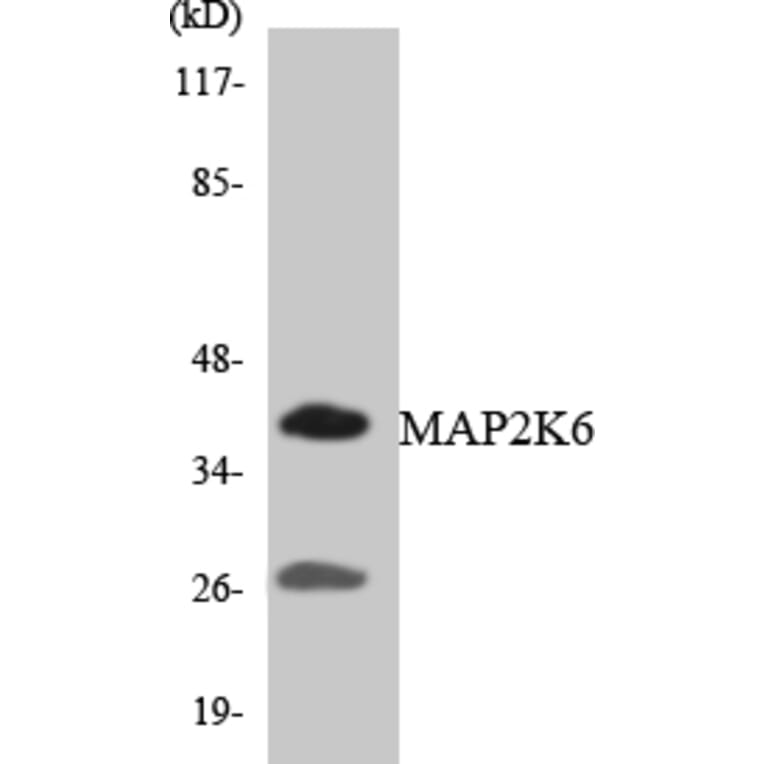Western Blot - MAP2K6 Cell Based ELISA Kit (CB5914) - Antibodies.com