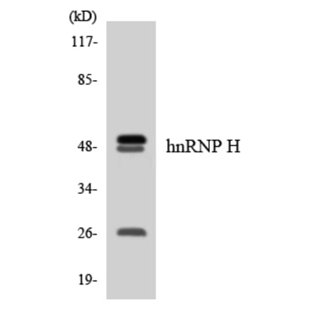 Western Blot - hnRNPH Cell Based ELISA Kit (CB5929) - Antibodies.com
