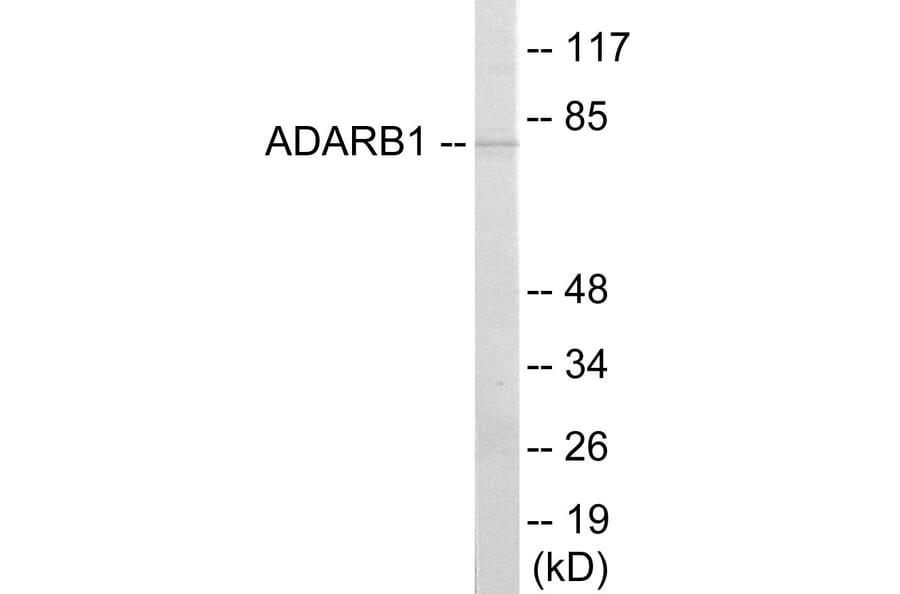 Western Blot - ADARB1 Cell Based ELISA Kit (CB5942) - Antibodies.com
