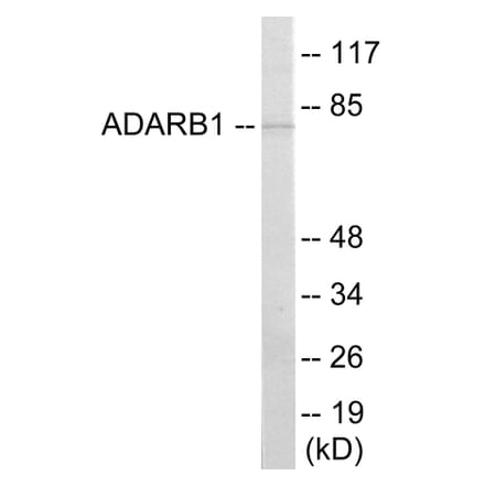 Western Blot - ADARB1 Cell Based ELISA Kit (CB5942) - Antibodies.com