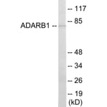 Western Blot - ADARB1 Cell Based ELISA Kit (CB5942) - Antibodies.com