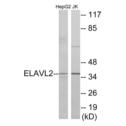 Western Blot - ELAVL2 Cell Based ELISA Kit (CB5976) - Antibodies.com