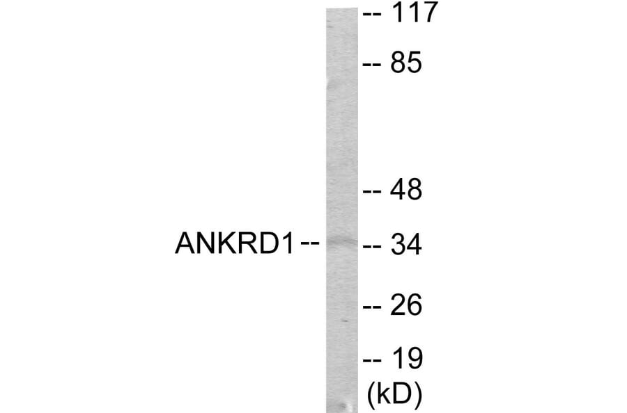 Western Blot - ANKRD1 Cell Based ELISA Kit (CB6017) - Antibodies.com