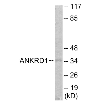 Western Blot - ANKRD1 Cell Based ELISA Kit (CB6017) - Antibodies.com