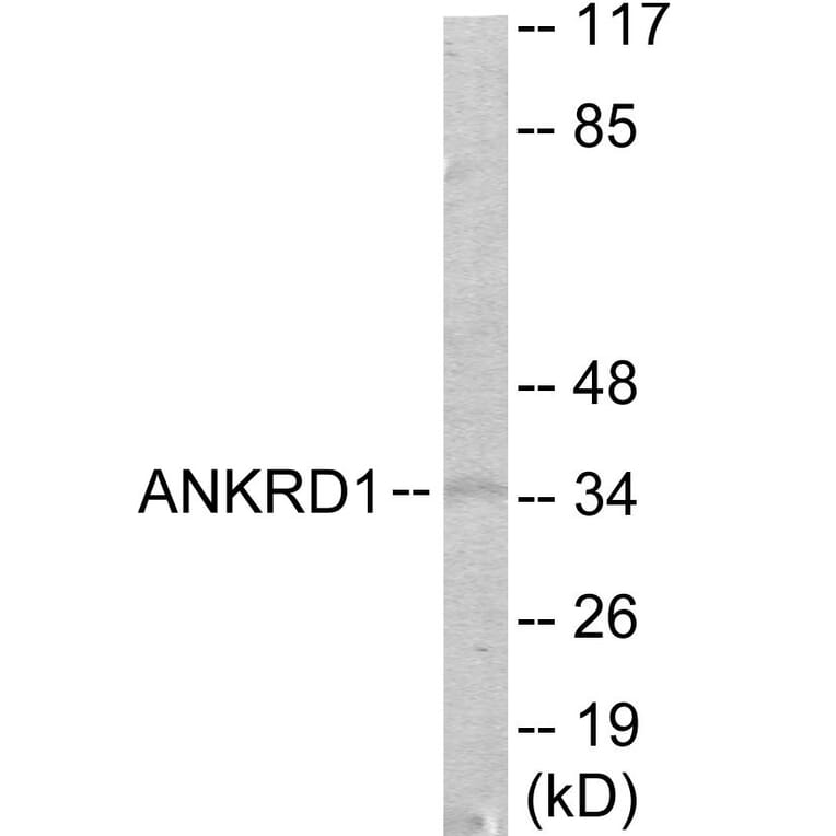 Western Blot - ANKRD1 Cell Based ELISA Kit (CB6017) - Antibodies.com
