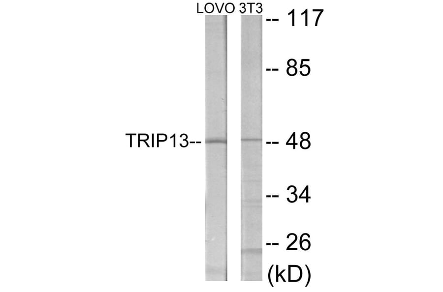 Western Blot - TRIP13 Cell Based ELISA Kit (CB6025) - Antibodies.com