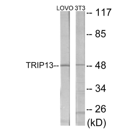 Western Blot - TRIP13 Cell Based ELISA Kit (CB6025) - Antibodies.com