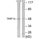 Western Blot - TRIP13 Cell Based ELISA Kit (CB6025) - Antibodies.com