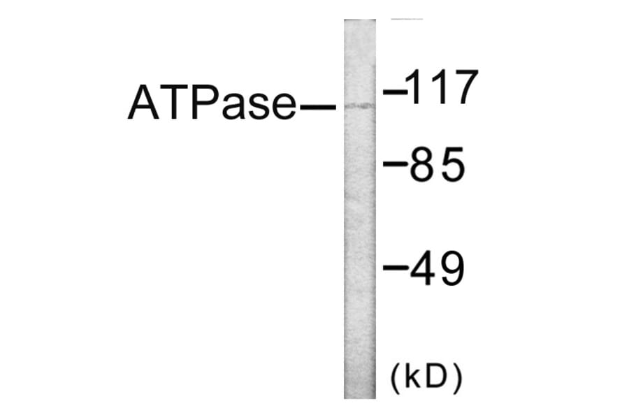 Western Blot - ATPase Cell Based ELISA Kit (CB6152) - Antibodies.com
