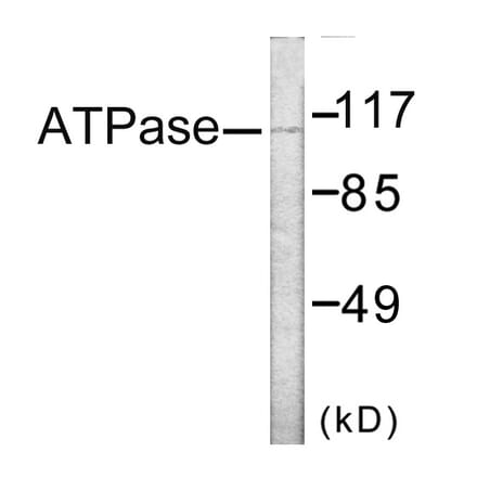 Western Blot - ATPase Cell Based ELISA Kit (CB6152) - Antibodies.com