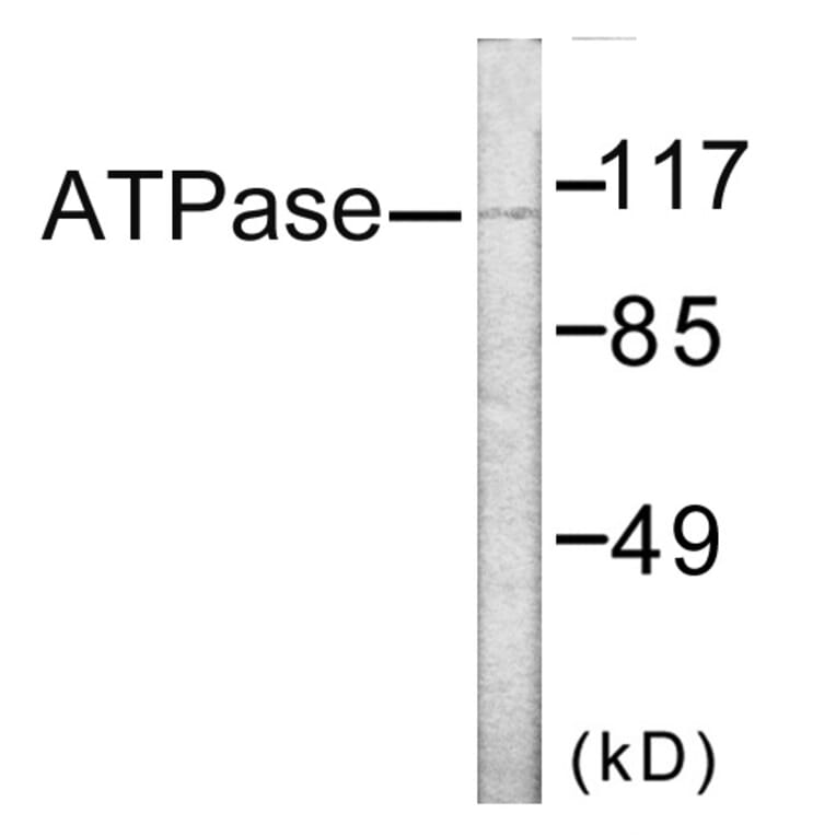 Western Blot - ATPase Cell Based ELISA Kit (CB6152) - Antibodies.com