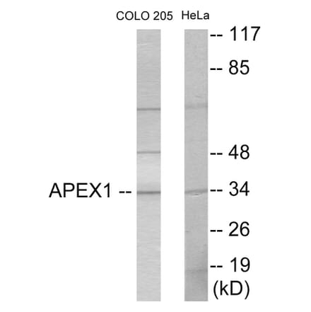 Western Blot - APEX1 Cell Based ELISA Kit (CB5867) - Antibodies.com