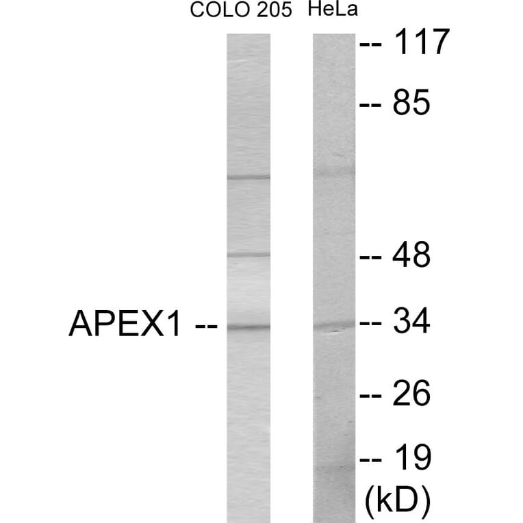 Western Blot - APEX1 Cell Based ELISA Kit (CB5867) - Antibodies.com