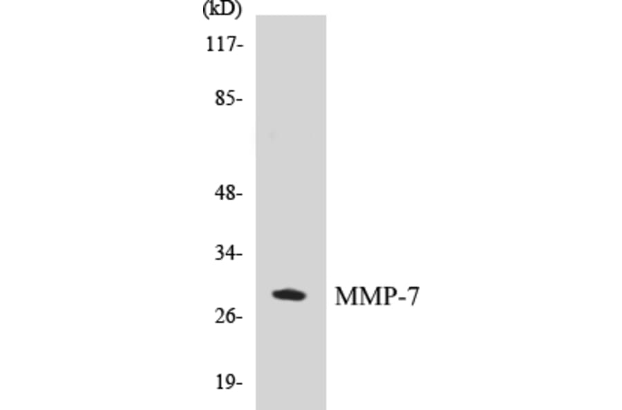 Western Blot - MMP-7 Cell Based ELISA Kit (CB5465) - Antibodies.com