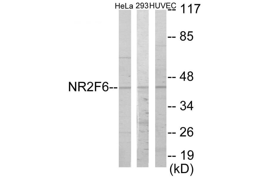 Western Blot - NR2F6 Cell Based ELISA Kit (CB5837) - Antibodies.com