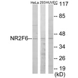 Western Blot - NR2F6 Cell Based ELISA Kit (CB5837) - Antibodies.com
