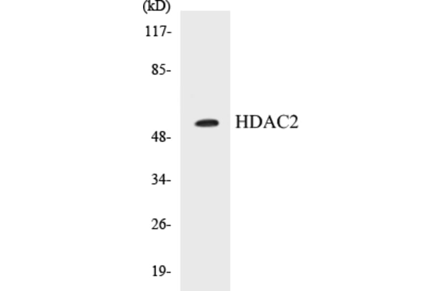 Western Blot - HDAC2 Cell Based ELISA Kit (CB5320) - Antibodies.com