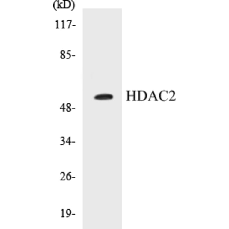 Western Blot - HDAC2 Cell Based ELISA Kit (CB5320) - Antibodies.com