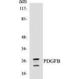 Western Blot - PDGFB Cell Based ELISA Kit (CB5543) - Antibodies.com