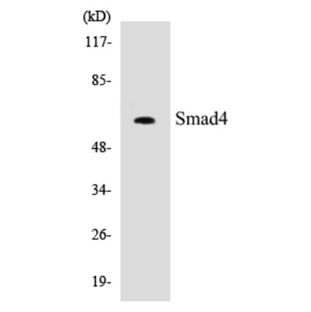 Western Blot - Smad4 Cell Based ELISA Kit (CB5641) - Antibodies.com