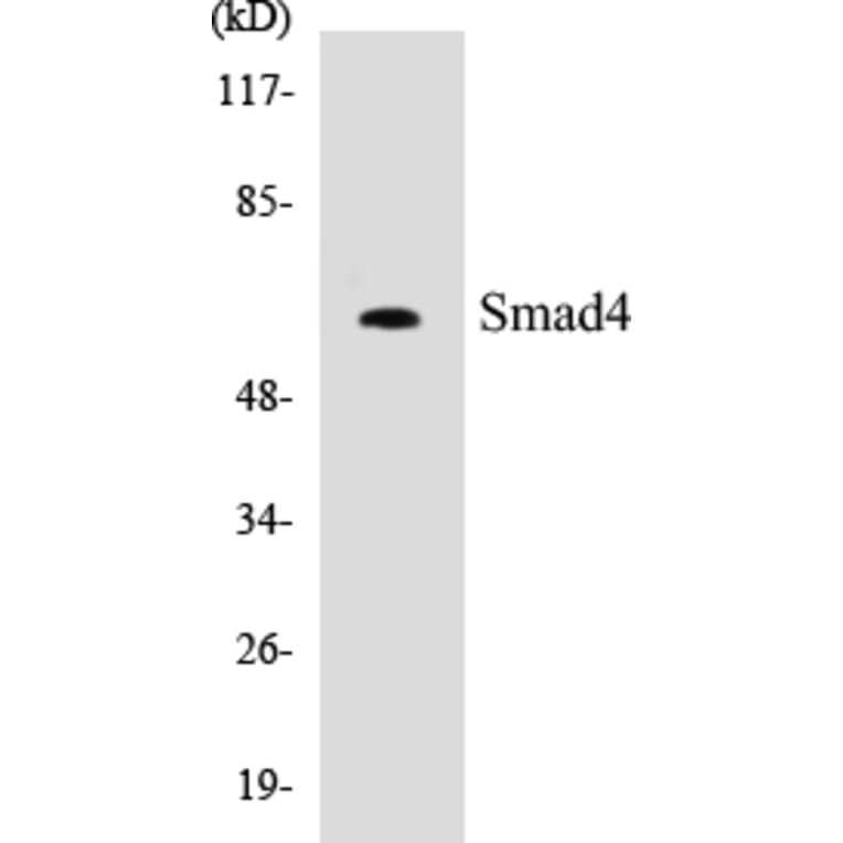 Western Blot - Smad4 Cell Based ELISA Kit (CB5641) - Antibodies.com