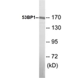 Western Blot - 53BP1 Cell Based ELISA Kit (CB5009) - Antibodies.com