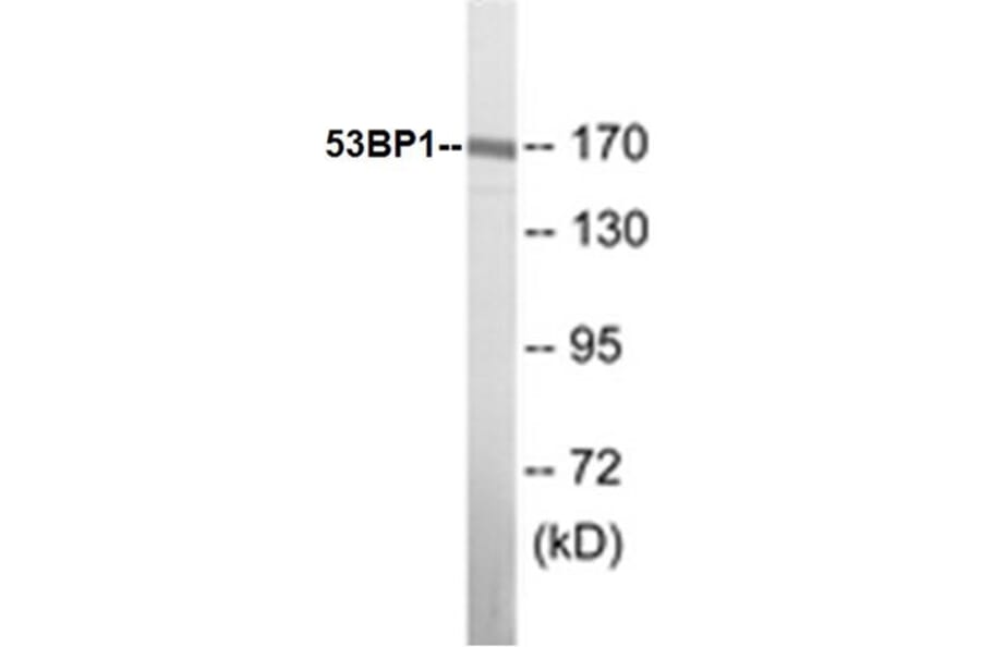 Western Blot - 53BP1 Cell Based ELISA Kit (CB5009) - Antibodies.com