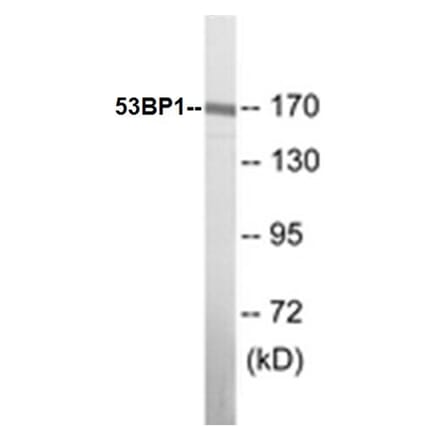 Western Blot - 53BP1 Cell Based ELISA Kit (CB5009) - Antibodies.com
