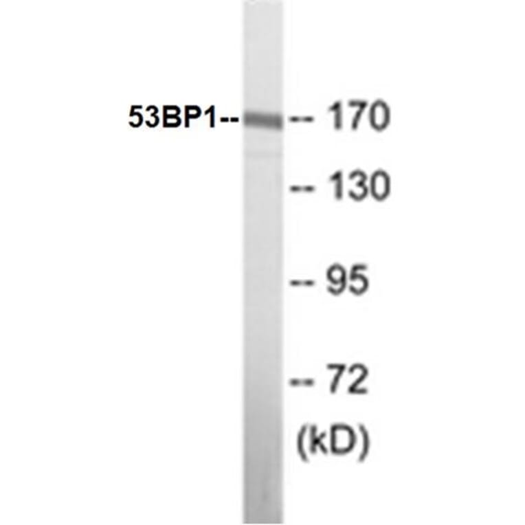 Western Blot - 53BP1 Cell Based ELISA Kit (CB5009) - Antibodies.com