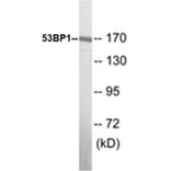 Western Blot - 53BP1 Cell Based ELISA Kit (CB5009) - Antibodies.com