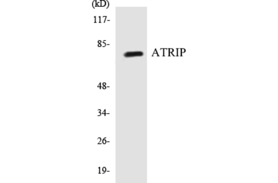 Western Blot - ATRIP Cell Based ELISA Kit (CB5060) - Antibodies.com