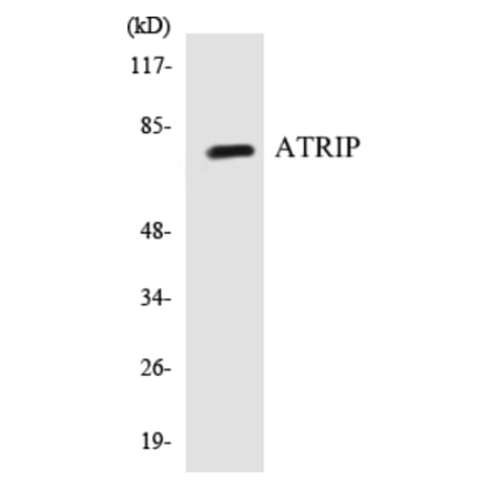 Western Blot - ATRIP Cell Based ELISA Kit (CB5060) - Antibodies.com