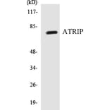 Western Blot - ATRIP Cell Based ELISA Kit (CB5060) - Antibodies.com