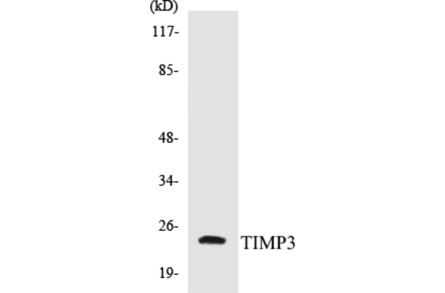 Western Blot - TIMP3 Cell Based ELISA Kit (CB5692) - Antibodies.com