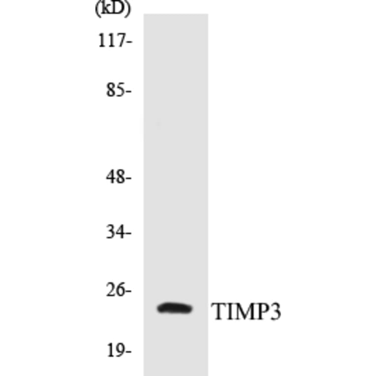 Western Blot - TIMP3 Cell Based ELISA Kit (CB5692) - Antibodies.com