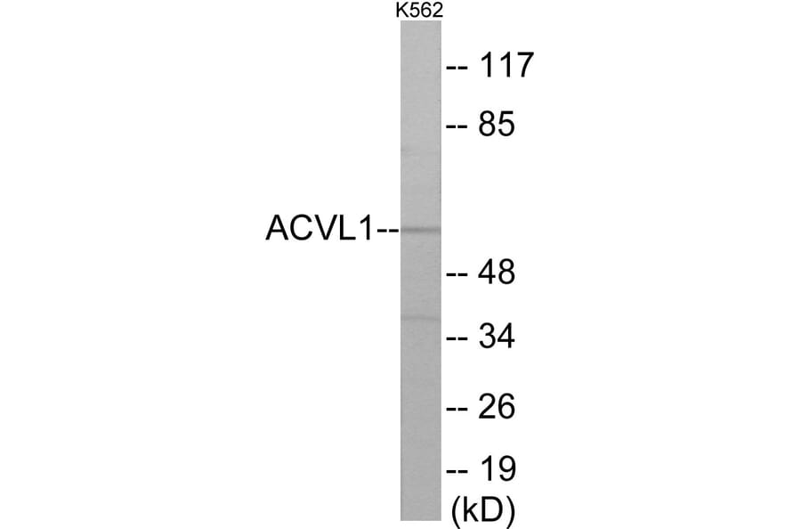 Western Blot - ACVL1 Cell Based ELISA Kit (CB5885) - Antibodies.com