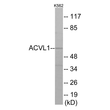 Western Blot - ACVL1 Cell Based ELISA Kit (CB5885) - Antibodies.com