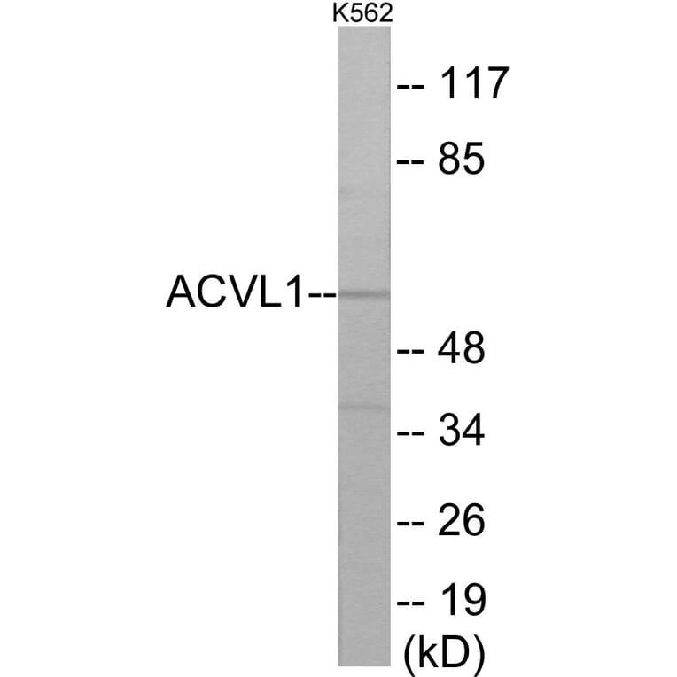 Western Blot - ACVL1 Cell Based ELISA Kit (CB5885) - Antibodies.com