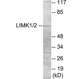 Western Blot - LIMK1 Cell Based ELISA Kit (CB5922) - Antibodies.com