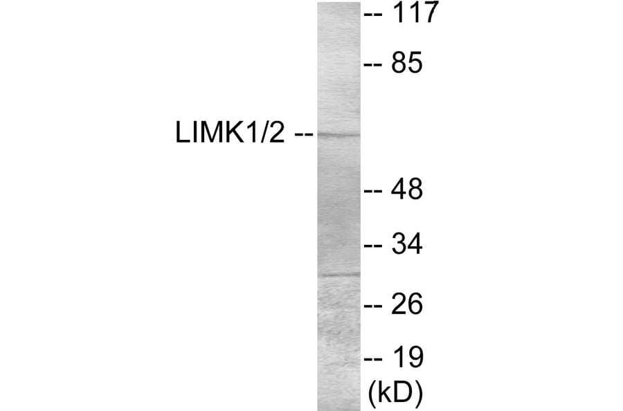 Western Blot - LIMK1 Cell Based ELISA Kit (CB5922) - Antibodies.com