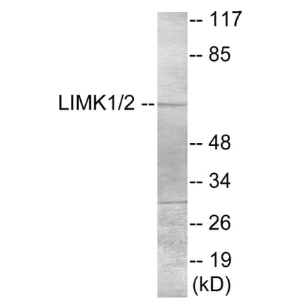 Western Blot - LIMK1 Cell Based ELISA Kit (CB5922) - Antibodies.com