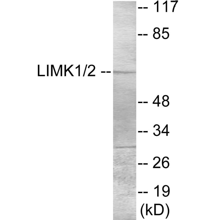 Western Blot - LIMK1 Cell Based ELISA Kit (CB5922) - Antibodies.com