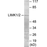 Western Blot - LIMK1 Cell Based ELISA Kit (CB5922) - Antibodies.com