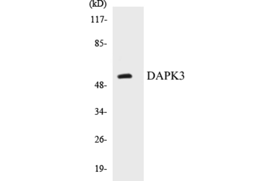 Western Blot - DAPK3 Cell Based ELISA Kit (CB5197) - Antibodies.com