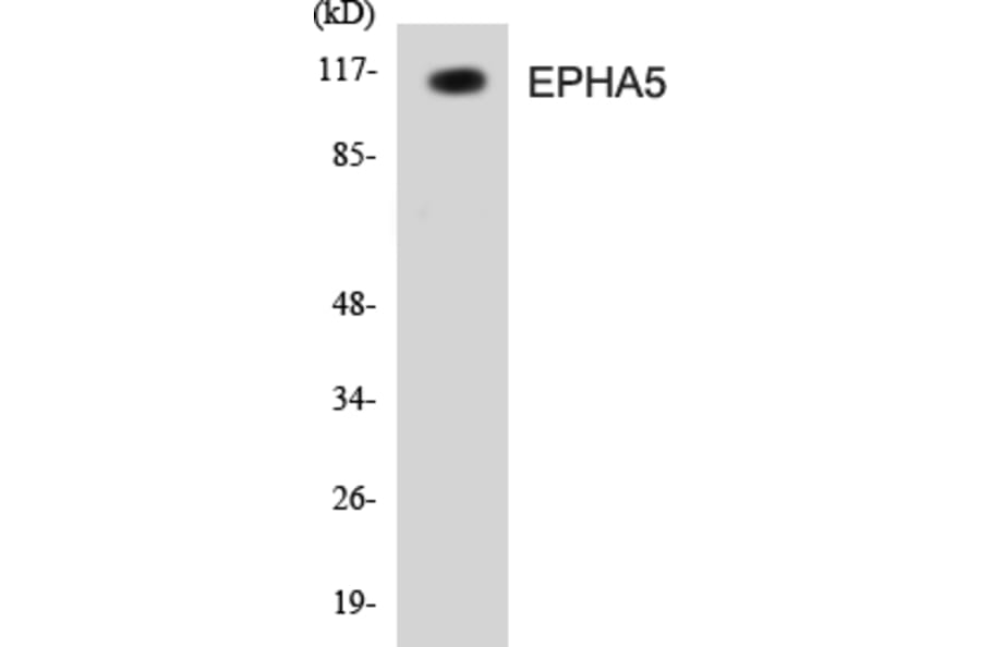 Western Blot - EPHA5 Cell Based ELISA Kit (CB5236) - Antibodies.com