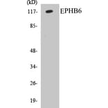Western Blot - EPHB6 Cell Based ELISA Kit (CB5242) - Antibodies.com